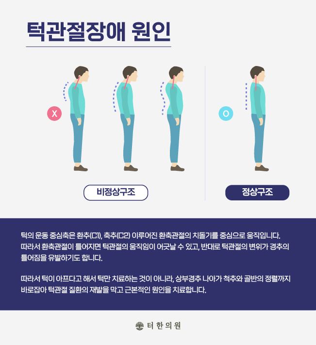 턱관절장애의 원인을 설명하는 카드뉴스